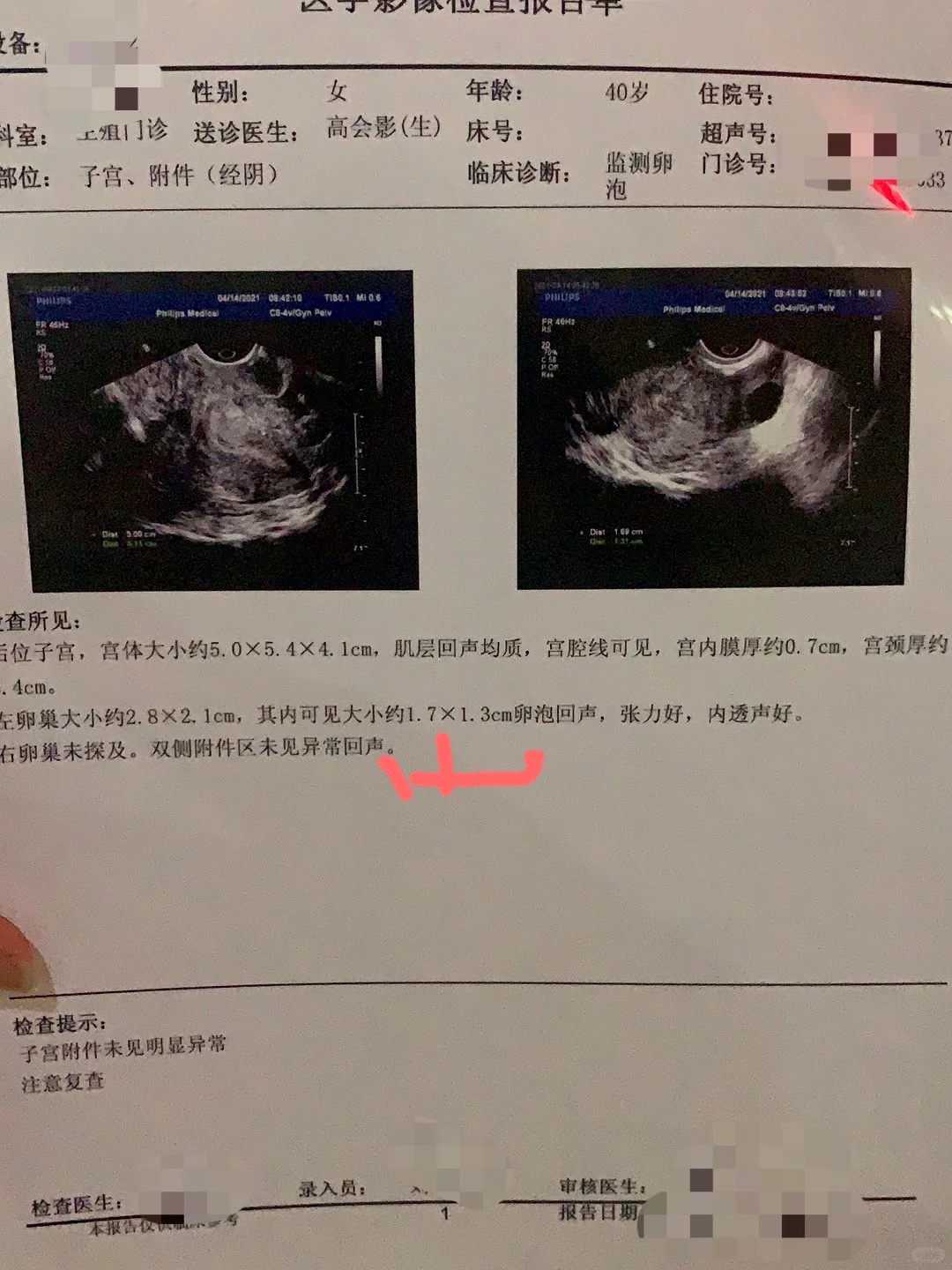 美国南加州生殖中心scrc包成功代生中介成功率有80%吗？收费高不高？